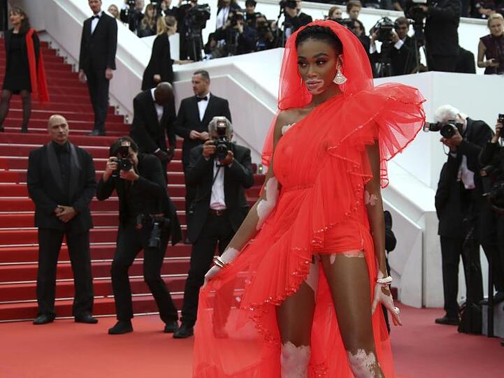 Spektakulärer Auftritt von Model Winnie Harlow.