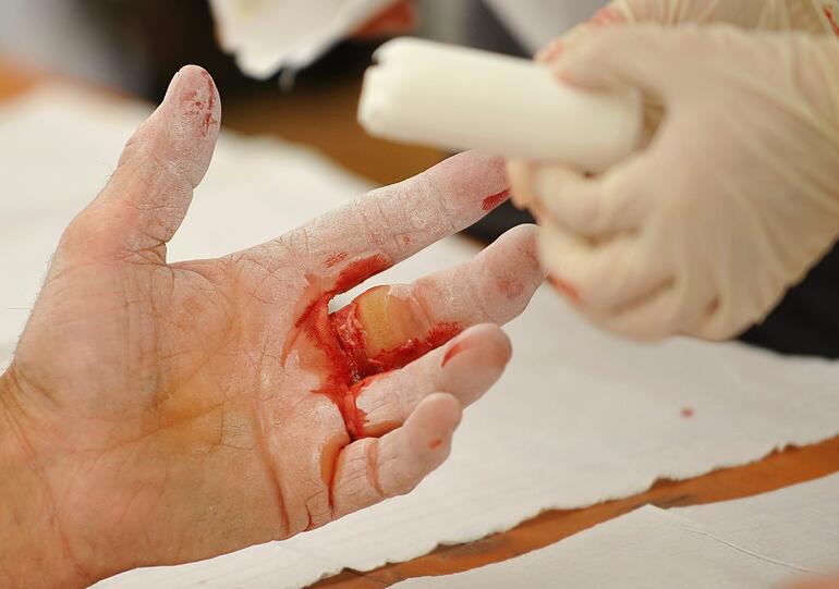 Blut fließt, Finger knacken: In Lenggries haben am Sonntag die bayerischen Meisterschaften im Fingerhakeln stattgefunden.
