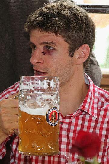 Müller trägt ein Andenken ans Hoffenheim-Spiel um das linke Auge.