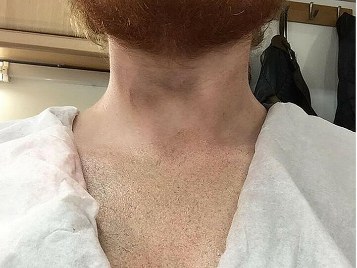 Ed Sheeran reckt seine Brust in die Kamera - ein Tattoo ist nicht zu sehen