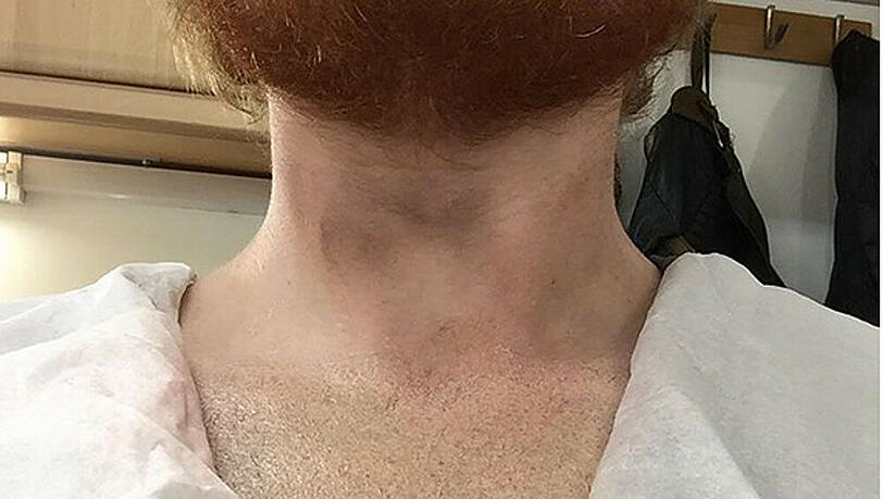 Ed Sheeran reckt seine Brust in die Kamera - ein Tattoo ist nicht zu sehen Ed Sheeran reckt seine Brust in die Kamera - ein Tattoo ist nicht zu sehen
