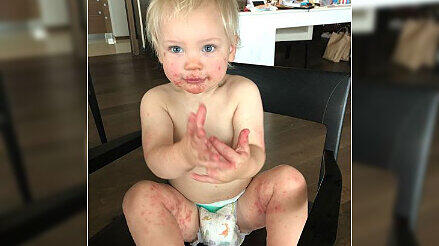 Jameson, der Sohn von Pink und Carey Hart, hat die sehr ansteckende Hand-Fuß-Mund-Krankheit.