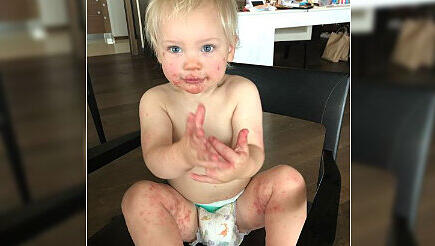 Jameson, der Sohn von Pink und Carey Hart, hat die sehr ansteckende Hand-Fuß-Mund-Krankheit. Jameson, der Sohn von Pink und Carey Hart, hat die sehr ansteckende Hand-Fuß-Mund-Krankheit.