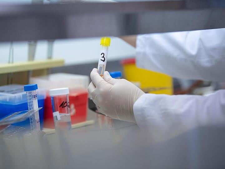 Eine Ärztin zeigt in einem Labor einen Test für das Coronavirus. (Symbolbild)