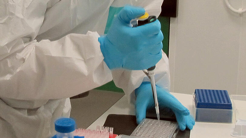 Mittels DNA-Treffer konnte ein versuchter Einbruch in Kleinhadern aufgeklärt werden. (Symbolbild)