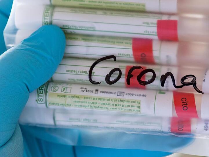 Proben für Corona-Tests werden für die weitere Untersuchung vorbereitet. Die Zahl der Infektionen nimmt in Deutschland weiter zu.