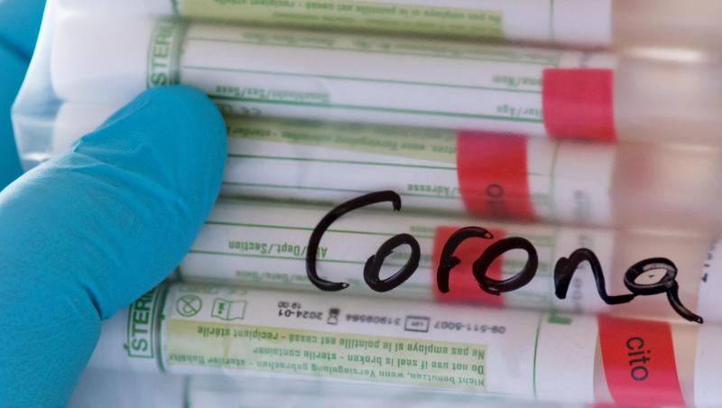 Proben für Corona-Tests werden für die weitere Untersuchung vorbereitet. Die Zahl der Infektionen nimmt in Deutschland weiter zu. Proben für Corona-Tests werden für die weitere Untersuchung vorbereitet. Die Zahl der Infektionen nimmt in Deutschland weiter zu.