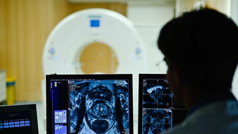 Ein Mitarbeiter betrachtet in einem Kontrollraum des Deutschen Krebsforschungszentrum (DKFZ) auf einem Monitor das Querschnittsbild einer Prostata.