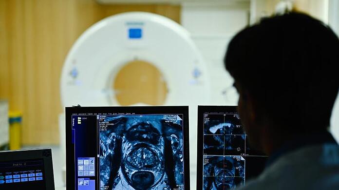 Ein Mitarbeiter betrachtet in einem Kontrollraum des Deutschen Krebsforschungszentrum (DKFZ) auf einem Monitor das Querschnittsbild einer Prostata.