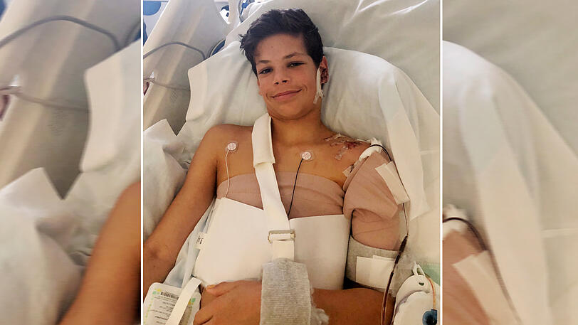 Dieses von der Rady Kinderklinik zur Verfügung gestellte Foto zeigt den 13-jährigen Keane Webre-Hayes, der nach einer Hai-Attacke behandelt wird.