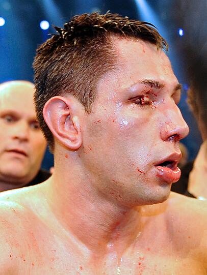 Boxweltmeister Felix Sturm (l) verteidigte erfolgreich seinen Titel gegen den irischen Herausforderer Matthew Macklin. Die Bilder vom Kampf.