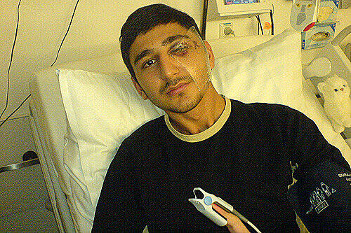 Übel zugerichtet: das Opfer nach dem brutalen Angriff.
