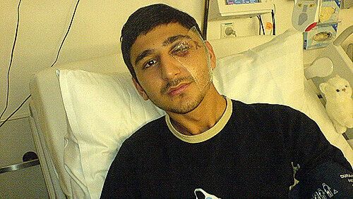 Übel zugerichtet: das Opfer nach dem brutalen Angriff. Übel zugerichtet: das Opfer nach dem brutalen Angriff.