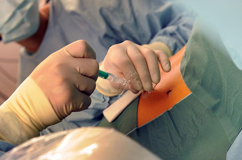 Nach Einschätzung der Techniker Krankenkasse werden in Deutschland viel zu viele Rückenoperationen vorgenommen.