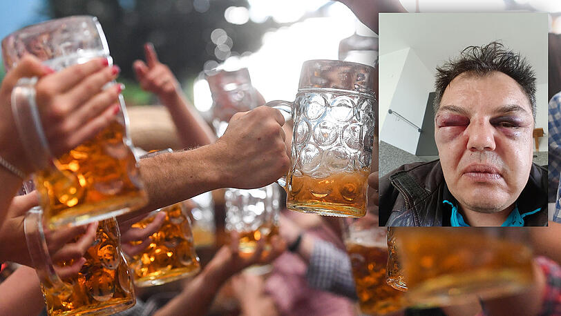 Während der Wiesn wird ein Busfahrer blutig geschlagen. Doch wo sind die Täter?