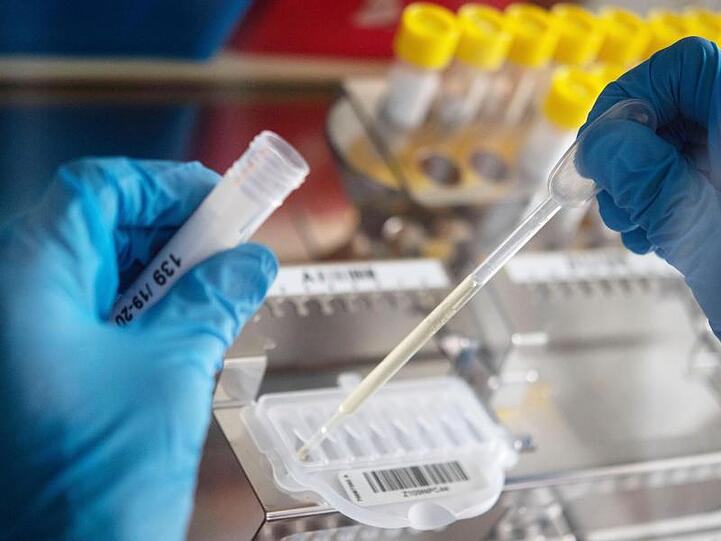 Eine Mitarbeiterin des Landesgesundheitsamtes pipettiert Proben mit Verdacht auf Influenza-Viren. Foto: Marijan Murat/dpa/Archivbild