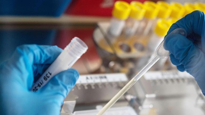 Eine Mitarbeiterin des Landesgesundheitsamtes pipettiert Proben mit Verdacht auf Influenza-Viren. Foto: Marijan Murat/dpa/Archivbild Eine Mitarbeiterin des Landesgesundheitsamtes pipettiert Proben mit Verdacht auf Influenza-Viren. Foto: Marijan Murat/dpa/Archivbild