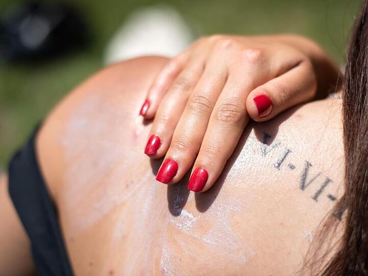 Vorbeugen ist besser als heilen: Bei diesen heißen Temperaturen braucht vor allem die Haut Schutz. Sonnencreme einpacken!