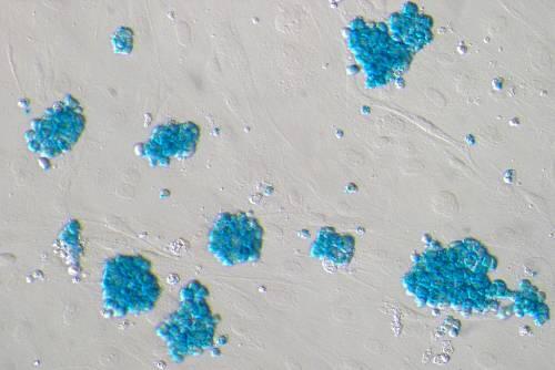 Neue Therapie-Hoffnung: Die Forscher wollen aus körpereigenen Stammzellen (siehe Foto) eine Insulin-produzierende Betazelle der Bauchspeicheldrüse entwickeln.