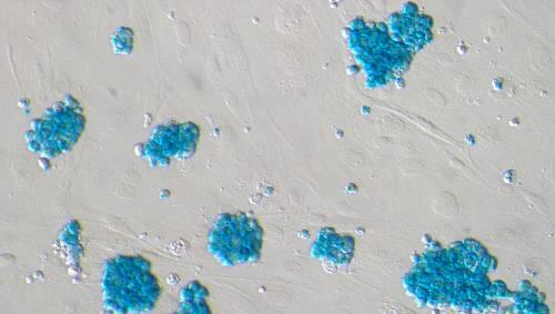 Neue Therapie-Hoffnung: Die Forscher wollen aus körpereigenen Stammzellen (siehe Foto) eine Insulin-produzierende Betazelle der Bauchspeicheldrüse entwickeln. Neue Therapie-Hoffnung: Die Forscher wollen aus körpereigenen Stammzellen (siehe Foto) eine Insulin-produzierende Betazelle der Bauchspeicheldrüse entwickeln.