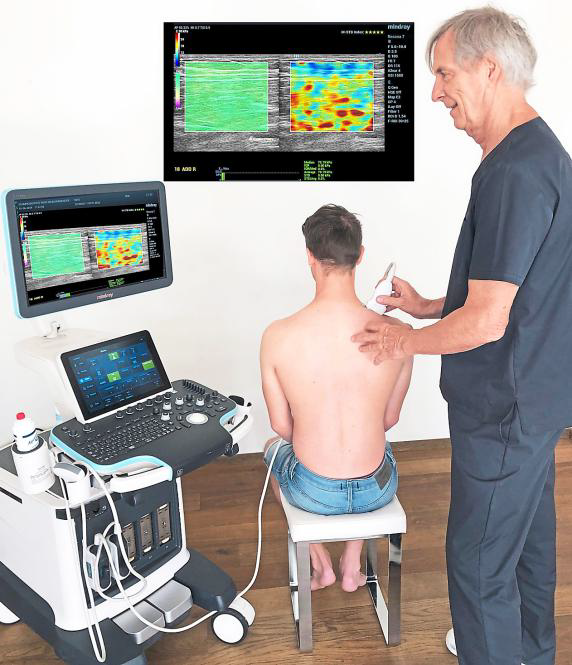 Prof. Dr. Bauermeister findet den Ursprung von Schmerzen, indem er die
Auslöser – die sogenannten Triggerpunkte – mittels Ultraschall-Elastografie
sichtbar macht. Prof. Dr. Bauermeister findet den Ursprung von Schmerzen, indem er die
Auslöser – die sogenannten Triggerpunkte – mittels Ultraschall-Elastografie
sichtbar macht.