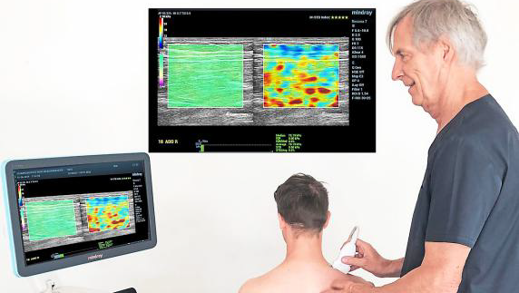 Prof. Dr. Bauermeister findet den Ursprung von Schmerzen, indem er die
Auslöser – die sogenannten Triggerpunkte – mittels Ultraschall-Elastografie
sichtbar macht. Prof. Dr. Bauermeister findet den Ursprung von Schmerzen, indem er die
Auslöser – die sogenannten Triggerpunkte – mittels Ultraschall-Elastografie
sichtbar macht.