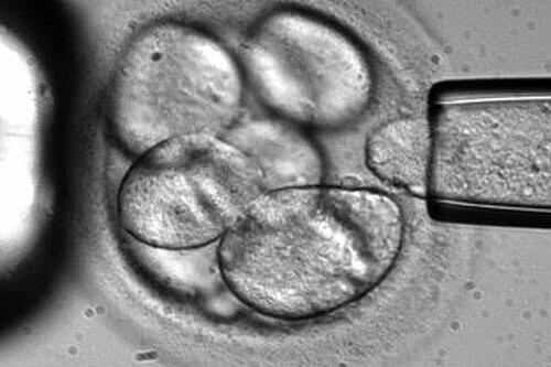 Das Bild zeigt, wie einem menschlichen Embryo Stammzellen entnommen werden. Der Embryo stirbt, die Zellen sollen der Forschung dienen.