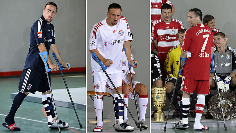 25. Juli 2008: Den alljährlichen Fototermin des FC Bayern mit den neuen Trikots absolviert Ribéry auf Krücken.