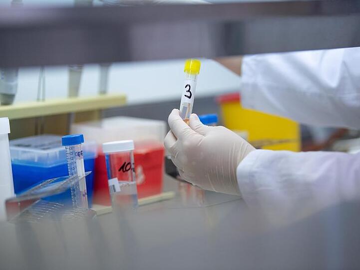 Eine Frau zeigt in einem Labor einen Test für das neue Virus 2019-nCov. Foto: Sebastian Gollnow/dpa/Symbolbild
