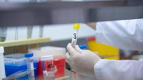 Eine Frau zeigt in einem Labor einen Test für das neue Virus 2019-nCov. Foto: Sebastian Gollnow/dpa/Symbolbild