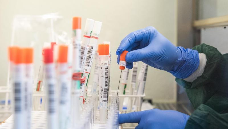Eine Mitarbeiterin eines Labors überführt einen trockenen Abstrich eines molekularbiologischen Tests auf das SARS-CoV-2-Virus in eine Flüssigkeit.