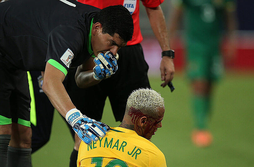 Die Neymar-Show beim 5:0 (4:0) im WM-Qualifikationsspiel gegen Bolivien fand nach einem Ellbogen-Stoß ihr spektakuläres, blutiges Schlussbild.