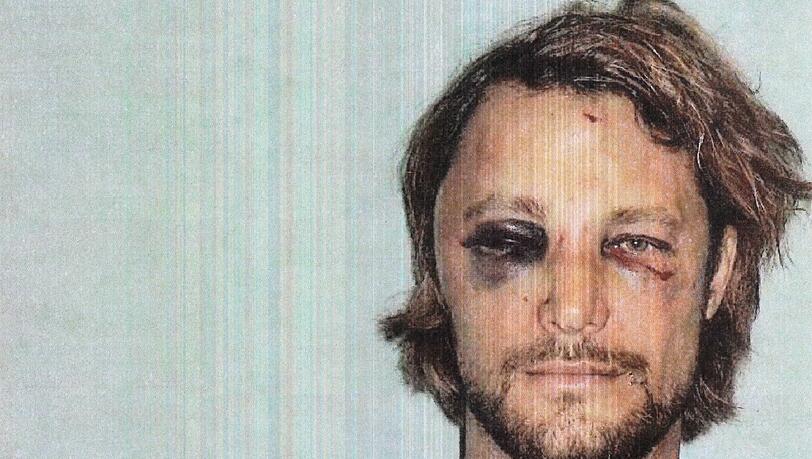 Er habe Verletzungen erlitten, darunter eine gebrochene Rippe,
Prellungen im Gesicht und Platzwunden, die genäht werden mussten. Das
Promi-Portal „TMZ.com“ veröffentlichte am Montag Fotos aus Aubrys
Gerichtsakte, die den Kanadier mit blau unterlaufenen Augen und
Wunden im Gesicht zeigen. Er habe Verletzungen erlitten, darunter eine gebrochene Rippe,
Prellungen im Gesicht und Platzwunden, die genäht werden mussten. Das
Promi-Portal „TMZ.com“ veröffentlichte am Montag Fotos aus Aubrys
Gerichtsakte, die den Kanadier mit blau unterlaufenen Augen und
Wunden im Gesicht zeigen.