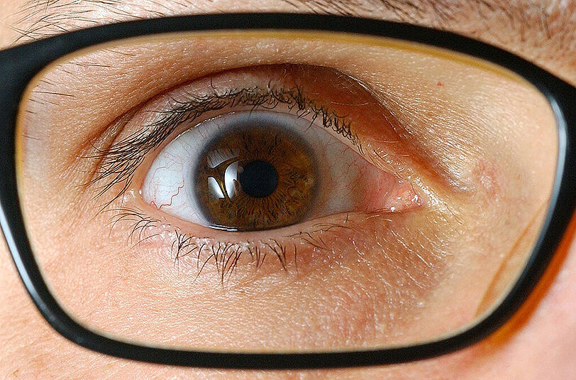Viele Krankheiten lassen sich an den Augen ablesen.