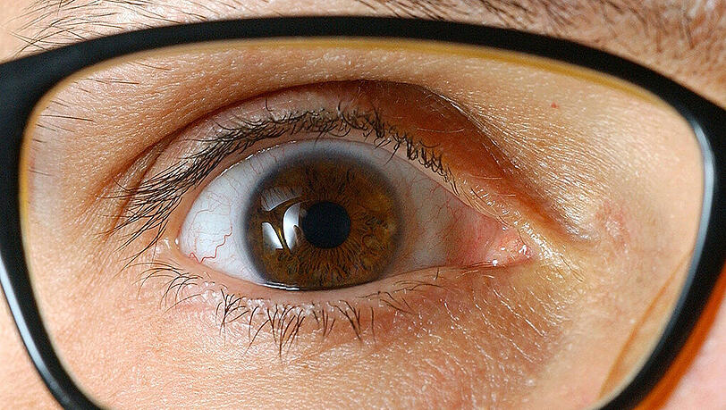 Viele Krankheiten lassen sich an den Augen ablesen.