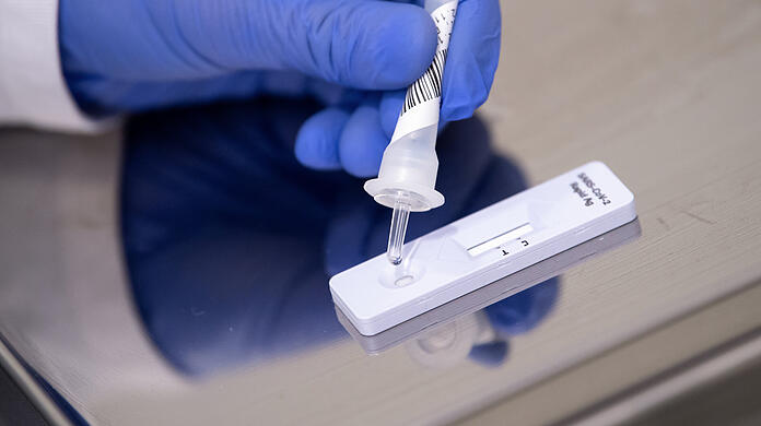 Antigen-Schnelltest zum COVID-19-Antikörper-Nachweis. (Symbolbild)