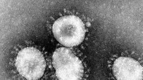 Ein Coronavirus unter dem Mikroskop. Foto: Center for Disease Control/epa/dpa/Archivbild