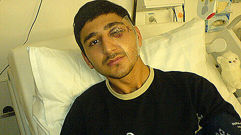 Mehmet B. im Krankenhaus &ndash; noch heute leidet der 21-jährige Einzelhandelskaufmann unter den Folgen der Attacke.