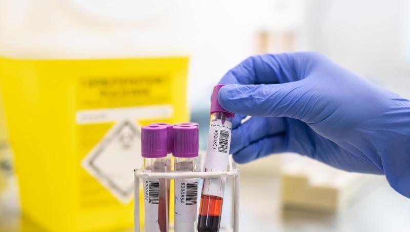 Blutproben in einem Diagnostiklabor. Blutproben in einem Diagnostiklabor.