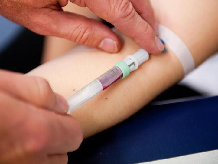 Seit 2012 werden Schwangeren Bluttests auf eigene Kosten angeboten, mit denen unter anderem untersucht wird, ob das Kind mit Down-Syndrom auf die Welt käme.
