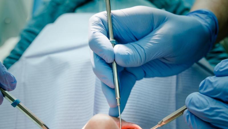 Ein Zahnarzt behandelt einen Patienten. Foto: Markus Scholz/dpa/Symbolbild Ein Zahnarzt behandelt einen Patienten. Foto: Markus Scholz/dpa/Symbolbild