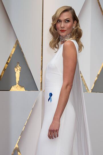 Karlie Kloss