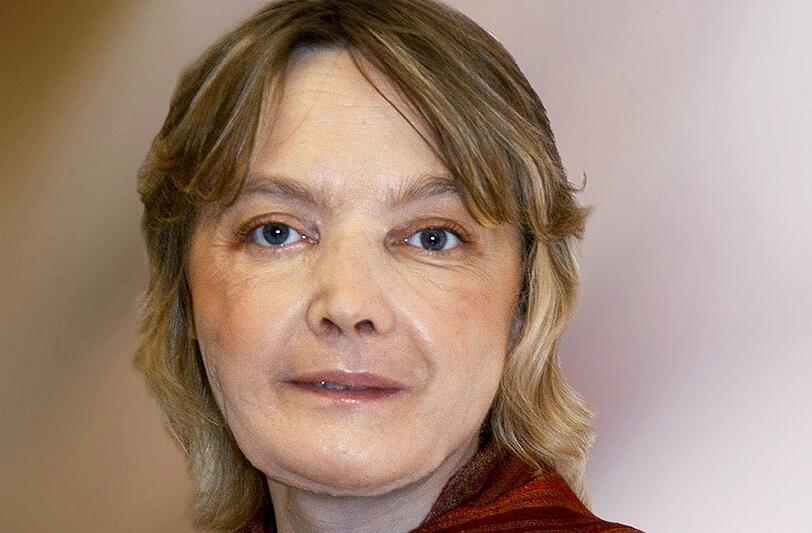 Die Französin Isabelle Dinoire, aufgenommen nach ihrer Gesichtsoperation. Foto: Chu Amiens
