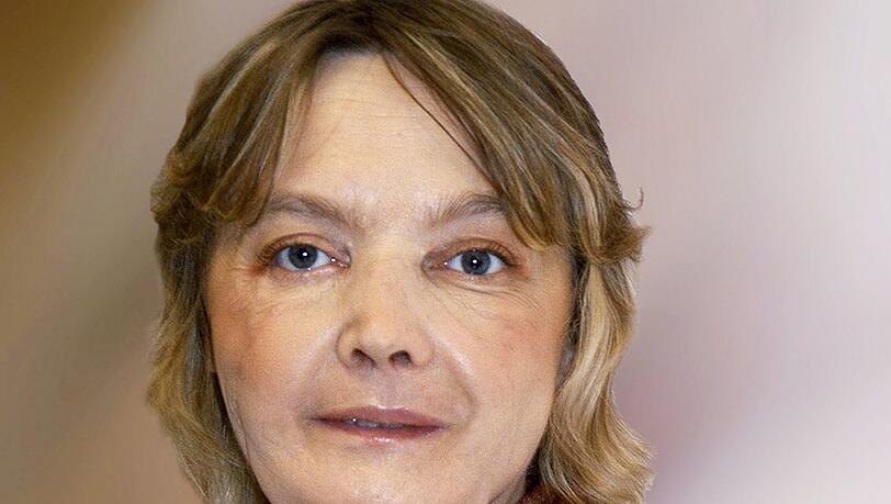 Die Französin Isabelle Dinoire, aufgenommen nach ihrer Gesichtsoperation. Foto: Chu Amiens Die Französin Isabelle Dinoire, aufgenommen nach ihrer Gesichtsoperation. Foto: Chu Amiens