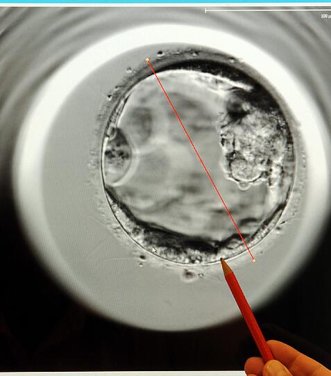 Auf einem Bildschirm ist ein mit einem EmbryoScope aufgenommener 5 Tage alter Embryo abgebildet.