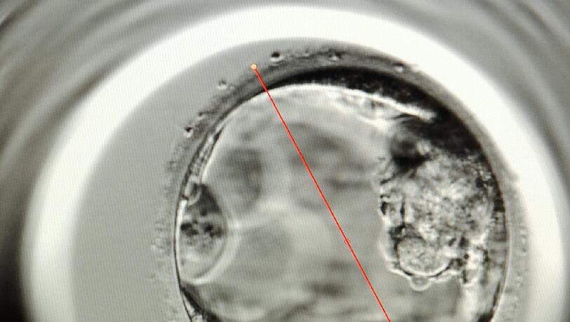 Auf einem Bildschirm ist ein mit einem EmbryoScope aufgenommener 5 Tage alter Embryo abgebildet. Auf einem Bildschirm ist ein mit einem EmbryoScope aufgenommener 5 Tage alter Embryo abgebildet.