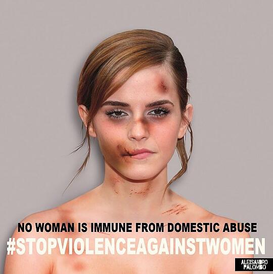 Emma Watson