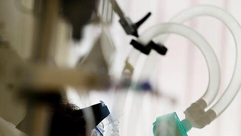 "Auch ein junger Patient ist nicht gefeit davor, einen schweren Verlauf zu haben", sagt der Chefarzt Clemens Wendtner von der Klinik für Infektiologie in der München Klinik Schwabing.