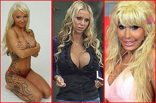 Der Schönheits-Wahn der Stars: Für riesige Brüste und sexy Figuren legen sich Promis gerne unters Messer. Doch mit der neuen Fassade gehen oft auch Schmerzen, Leid und viele Tränen einher. Im schlimmsten Fall enden riskante Beauty-Operationen sogar tödlich. Die AZ hat mal gesammelt, welche Promis sich offenkundig in die Hände der Schönheits-Chirurgen begeben haben.