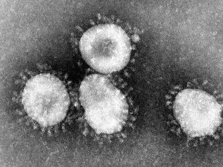 Ganz nah: Ein Coronavirus unter einem Mikroskop.